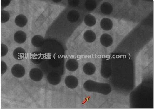 BGA因?yàn)楹笁|變小，造成錫膏過多而最終形成焊接短路的結(jié)果。